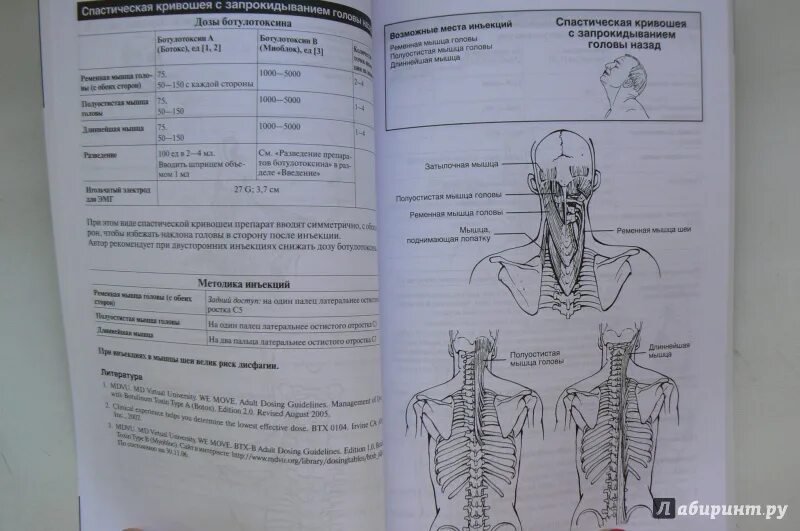Ботулинотерапия после инсульта. Протокол ботулинотерапии при ДЦП. Книги по ботулинотерапии. Ботулинотерапия. Карманный справочник - и. Оддерсон. Атлас ботулинотерапии в неврологии.
