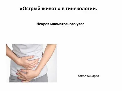 Острый живот в гинекологии клинические