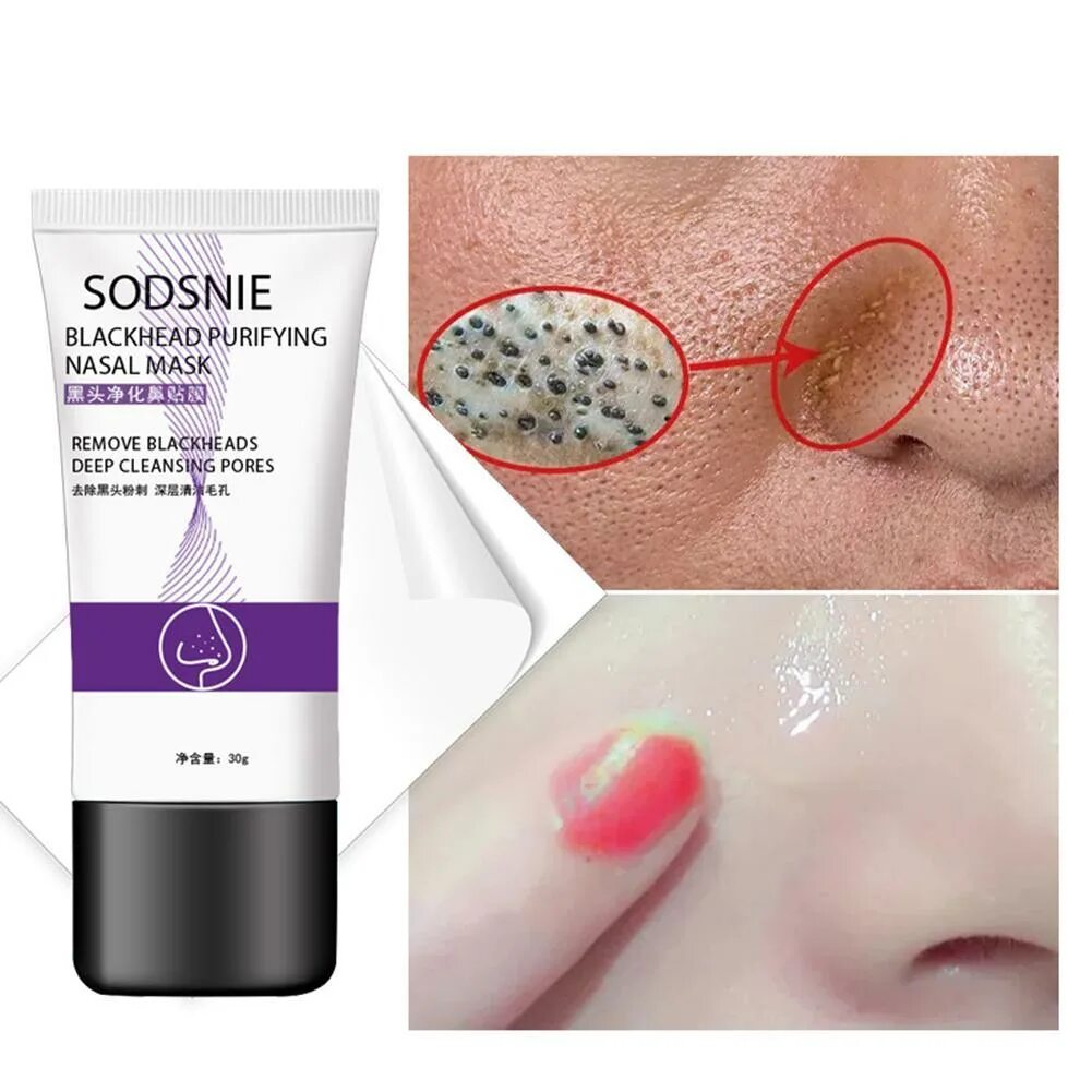 Blackhead remover на русский. Крем для очищения лица от прыщей. Точечная маска от прыщей.