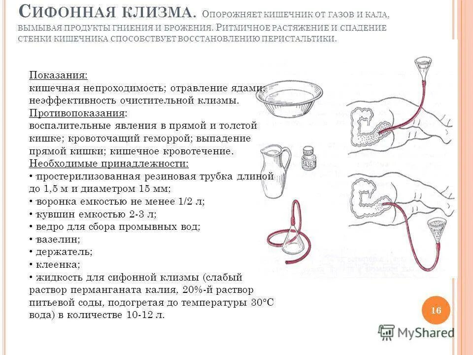 Можно делать клизму при геморрое. Постановка сифонной клизмы алгоритм. Сифонная клизма показания алгоритм. Алгоритм проведения сифонной клизмы. Методика постановки сифонной клизмы.