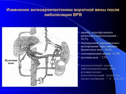 Воротная вена это