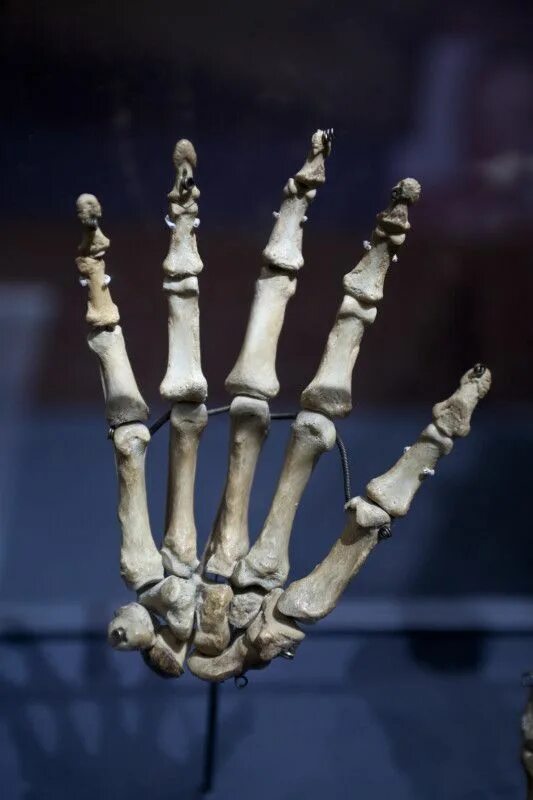 Кисть руки скелет. Скелет шестипалой ладони человека. Human hand Bone. Hand bone