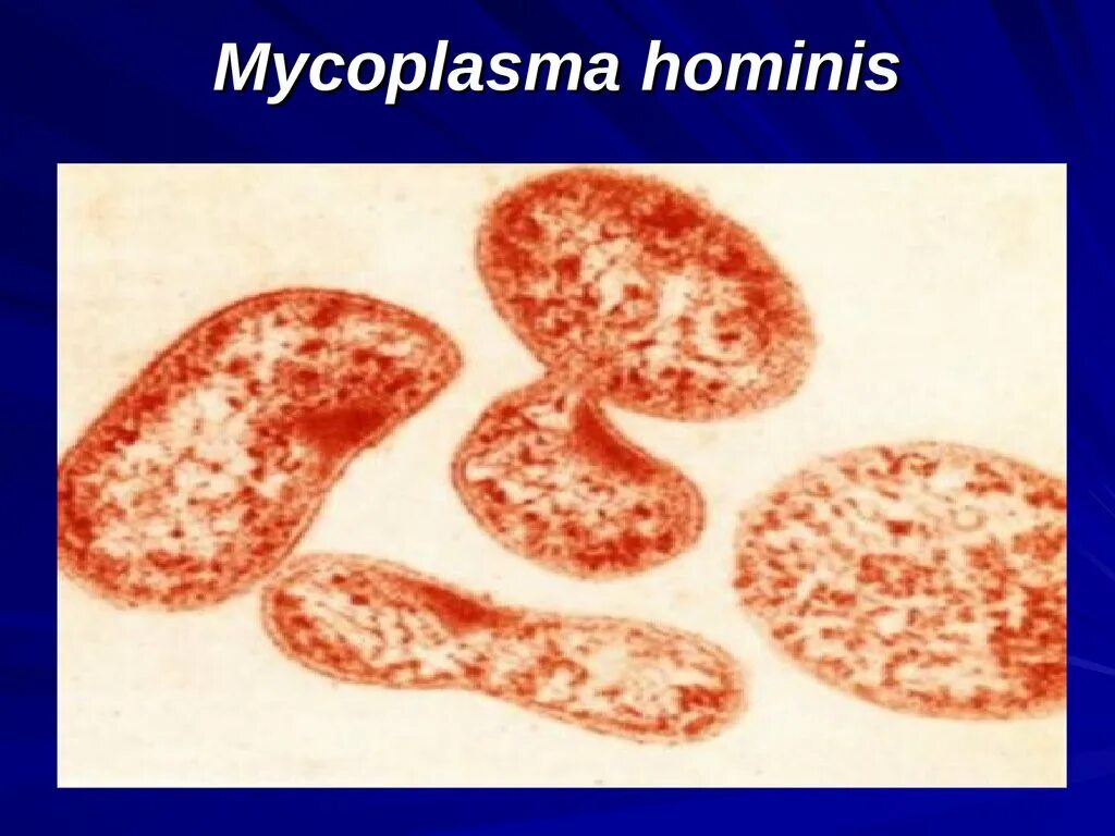 Mycoplasma hominis полукол днк. Микоплазма хоминис 1.58++. микоплазма гоминис mycoplasma. микоплазма гоминис m.hominis.