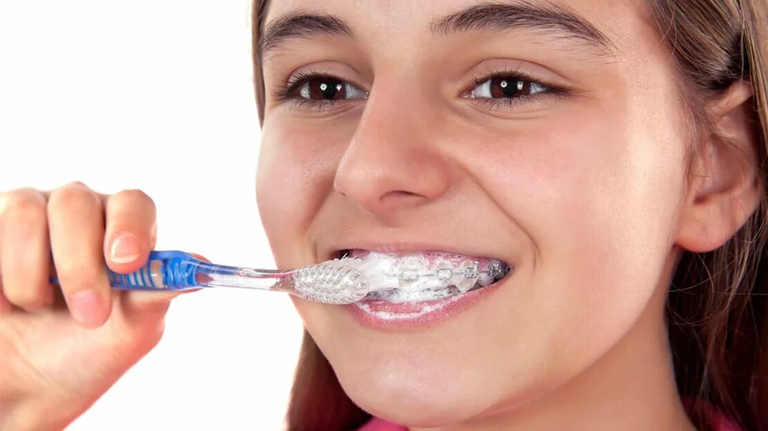 Мытье зубов. Гигиена полости рта с брекет системой. Чистим зубы!. Гигиена полости рта подростков.