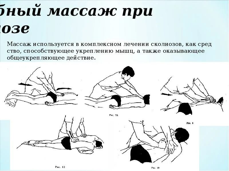 Массаж при s образном сколиозе. Массаж при s образном сколиозе