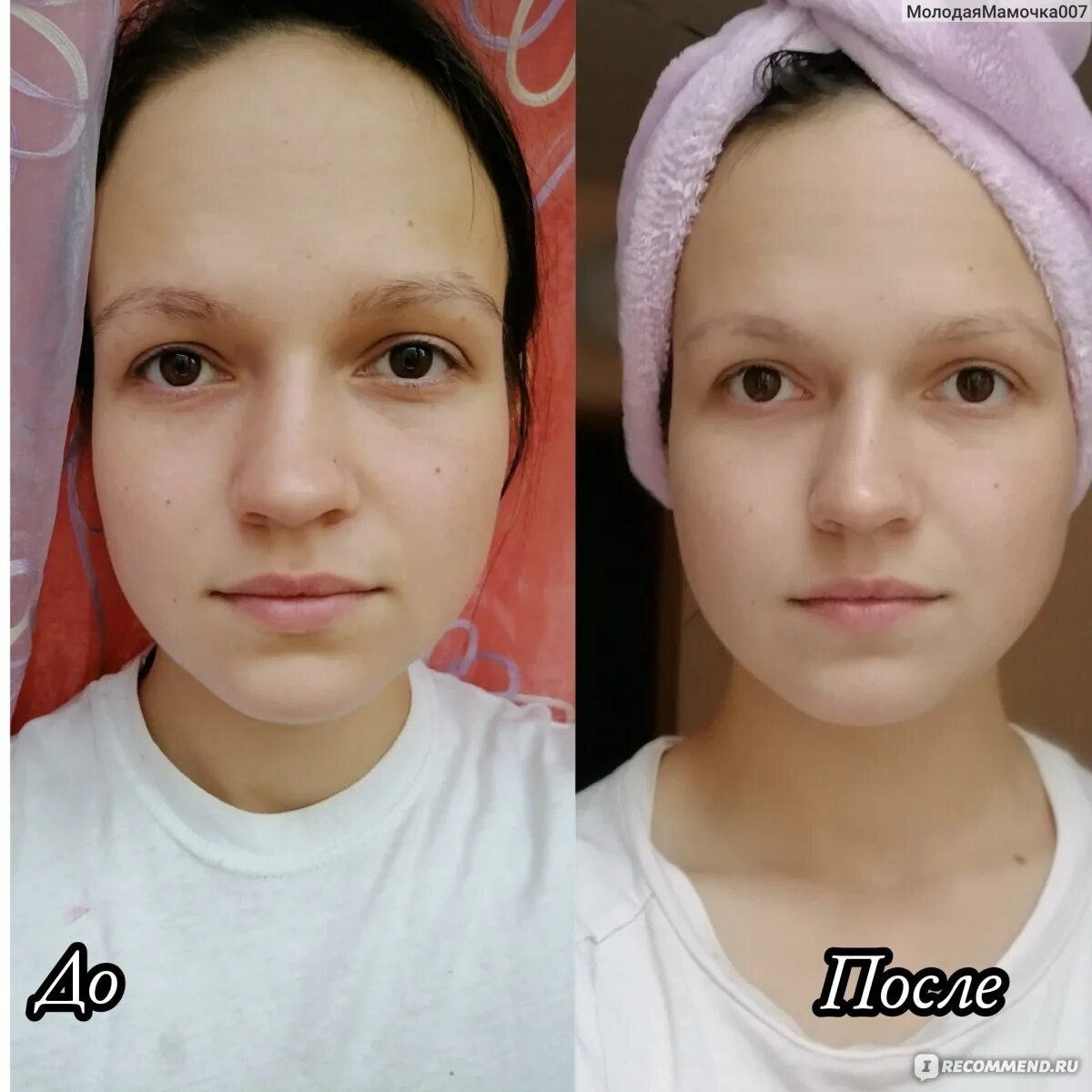 Скребок и ролик гуаша для лица. Массаж гуаша для лица. Гезатон скребок гуаша. Массаж лица скребком гуаша до и после. Массаж гуаша для лица.