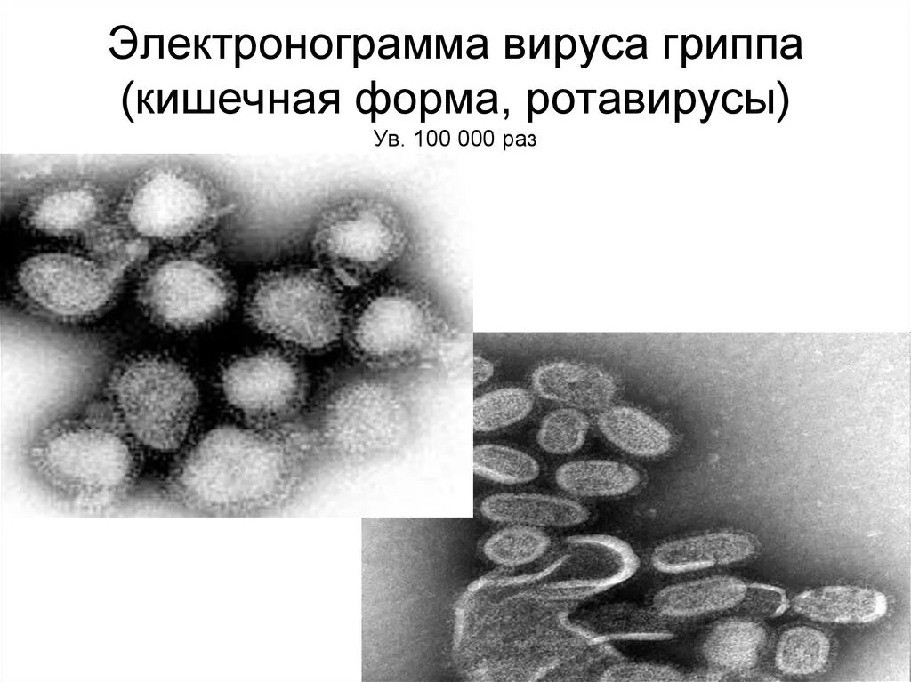 Желудочный грипп лечение у взрослых. Электронограмма вируса. Вирус кишечного гриппа. Грипп кишечная форма. Электронограмма апоптоза.