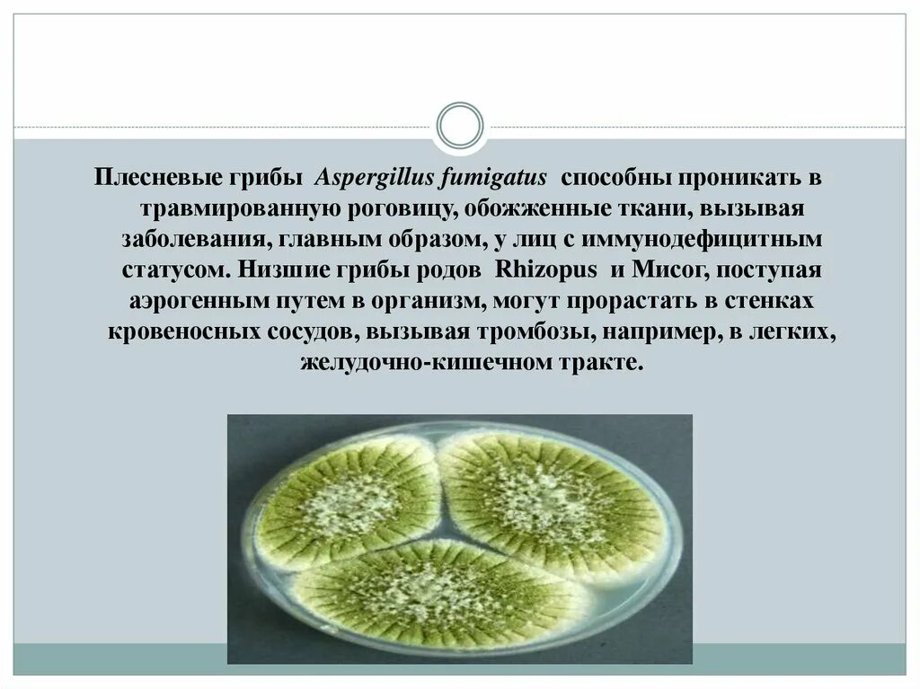 Низшие плесневые грибы. Грибы рода Aspergillus. Низшие грибы ризопус. Плесневые грибы рода Aspergillus. Плесневые грибы это низшие