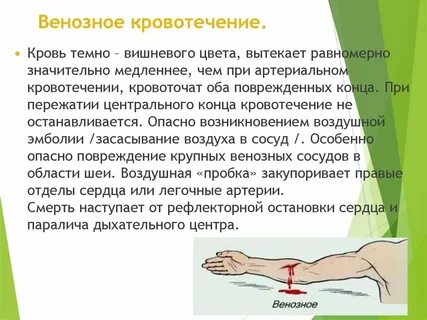 Наружное кровотечение симптомы