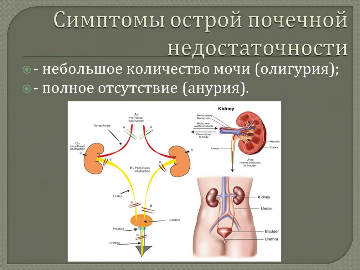 Почему отказывают почки и что происходит. Острая почечная недостаточность симптомы у мужчин. Симптомы при почечной недостаточности у женщин. Недостаточность почек симптомы. Симптомы почечнойтнкдостаточности.