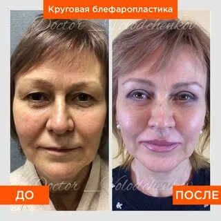 Пластическая хирургия уфа