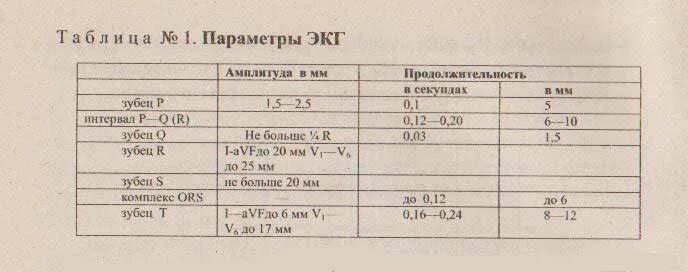 Экг норма расшифровка. Qrs норма экг. Ось qrs норма экг. Расшифровка экг норма для женщин. Расшифровка показаний экг показатели нормы.