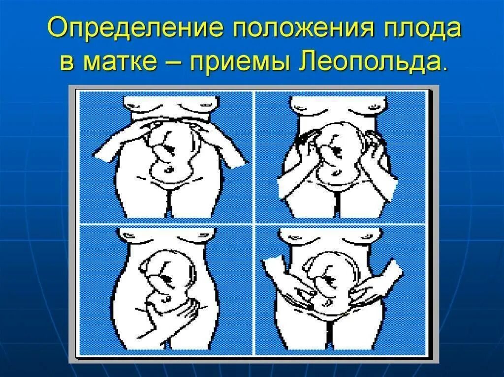 Установление положения. Положение плода. определение положения плода. положение плода определяется. положение и позиция плода.