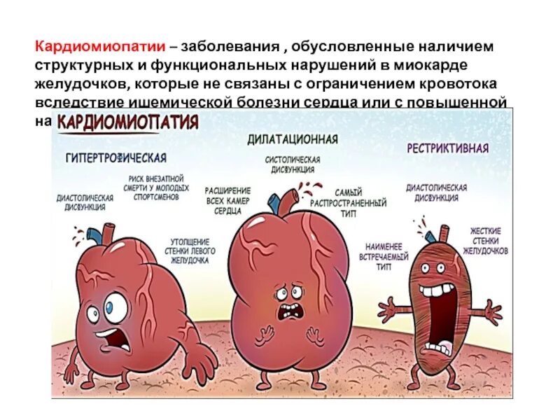 Кардиомиопатия что это такое. Клинические симптомы кардиомиопатии. рестриктивная кардиомиопатия рентген. рестриктивная кардиомиопатия клинические. кардиомиопатия презентация.
