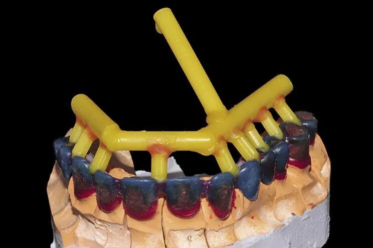 Литниковые системы для литья в стоматологии. Каркас бюгельного протеза. Зуботехническое литье. Каркас бюгельного протеза. Зуботехническое литье.