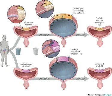 A figure which shows how good knowledge of the mechanical properties of a b...