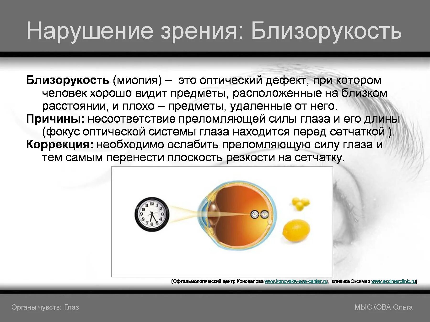 Структура дефекта при нарушениях зрения. Нарушение зрения близорукость. нарушение зрения миопия. причины нарушения зрения близорукость. первичный дефект при нарушении зрения.