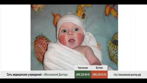 Аллергия на козье молоко
