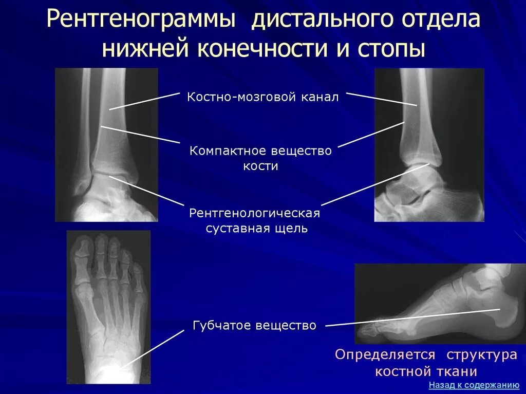 Кости дистального отдела стопы. Отделы кости на рентгенограмме. Дистальный участок конечности. Дистальные отделы конечностей.