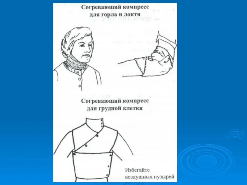 Техника наложения компресса. Наложение компресса. Схема постановки компресса. Компрессы места наложения. Согревающий компресс на область локтевого сгиба.
