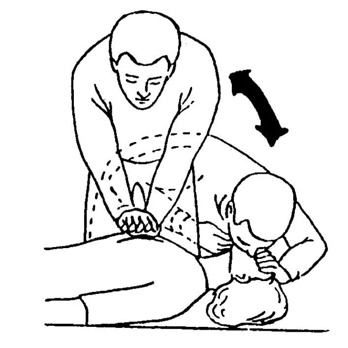 Руки в замок при сердечно легочной реанимации. Руки в замок при сердечно легочной. Расположение руки в замок при проведении СЛР. Расположение ладоней «в замок»при проведении компрессий:.