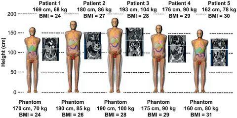 A Novel Method to Extend a Partial-Body CT for the Reconstruction of Dose t...