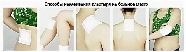 Можно ли клеить перцовый пластырь на поясницу