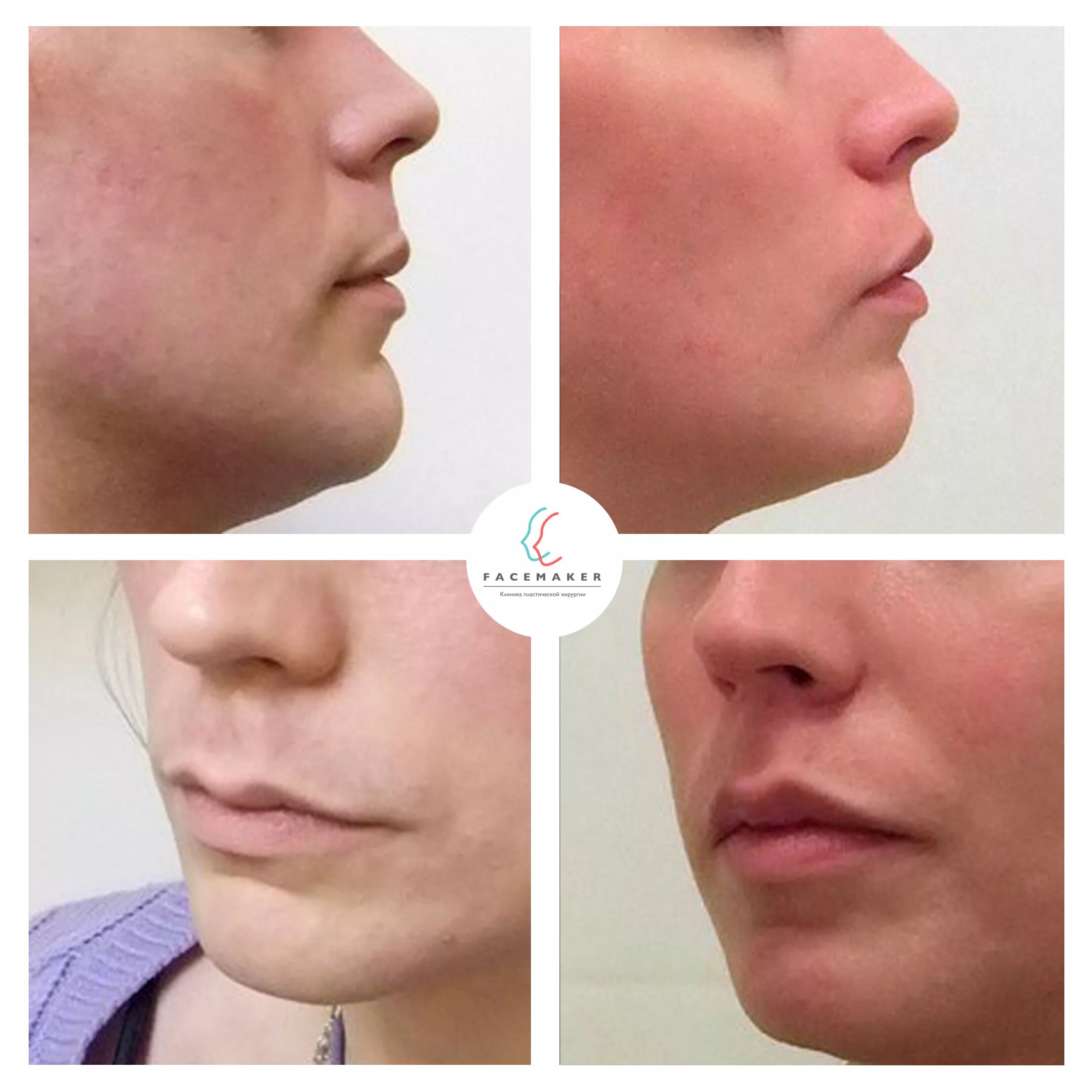 булхорн это