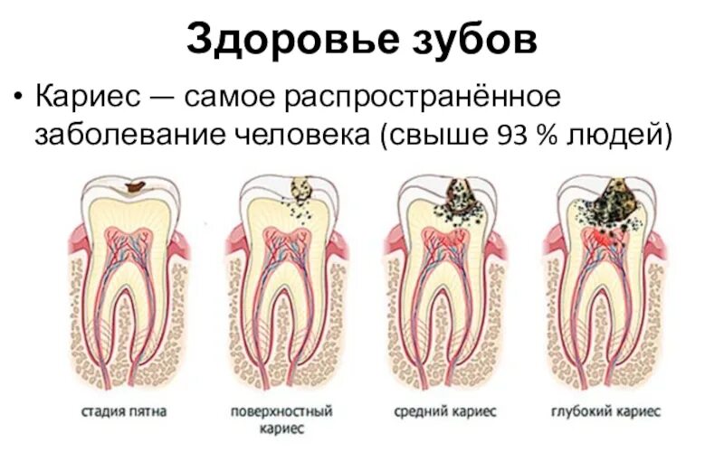 Лечение зуба 8