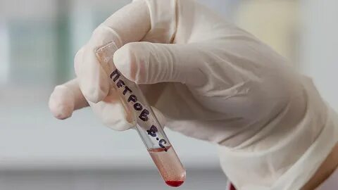 Резус совместимость в пробирке