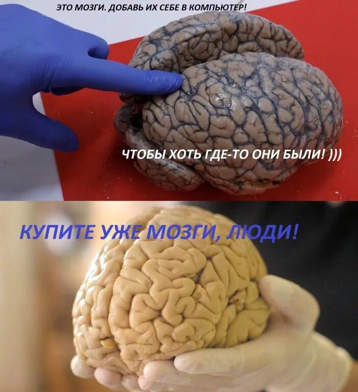 Мозги не на месте. Мозги нахождение. Богатый мозг.