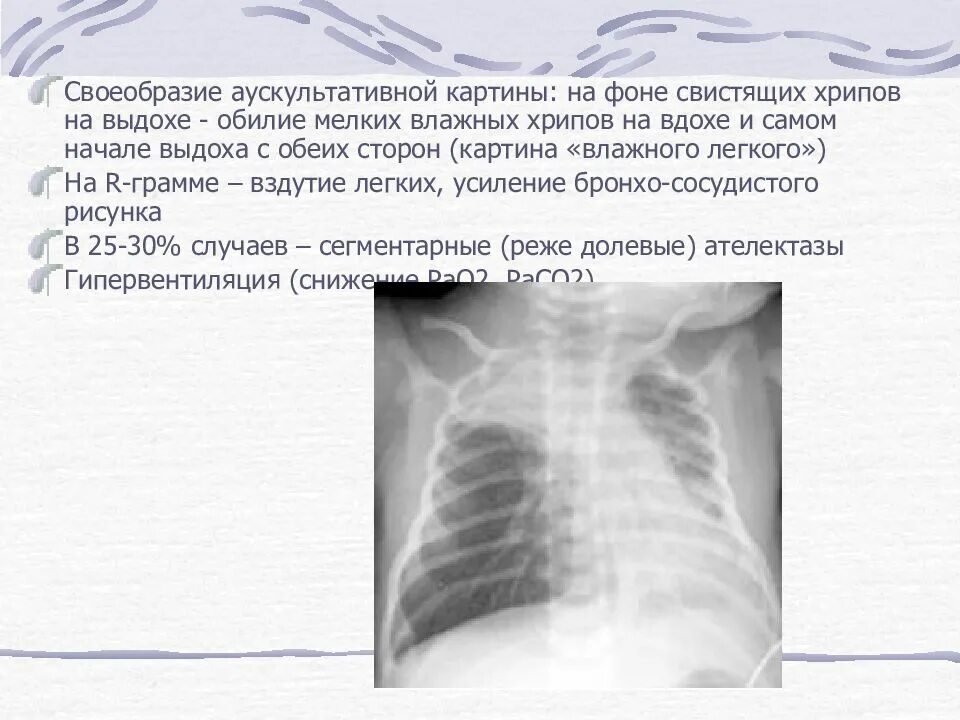 Свист в бронхах при выдохе причины. Хрипы на вдохе у ребенка. хрипы на вдохе и выдохе у ребенка. хрипы в легких при вдохе. хрипы при вдохе у ребенка.