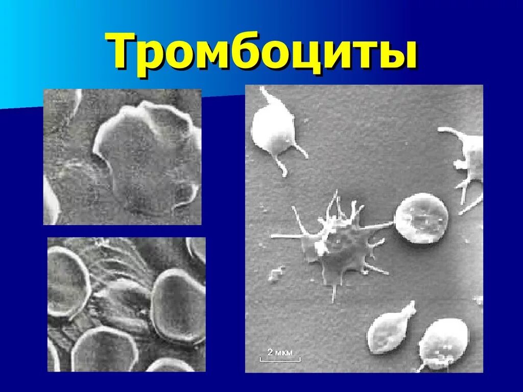 Тромбоциты снижены форум. Образование тромбоцитов. тромбоциты эстетика. эритроциты способны образовать ложноножки?. тромбоцит при болезни виллебранта.