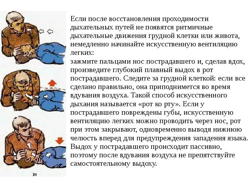 Последовательности этапы устранения непроходимости дыхательных путей. Непроходимость дыхательных путей. последовательность при непроходимости дыхательных путей. последовательность устранения непроходимости дыхательных путей. этапы устранения непроходимости дыхательных.