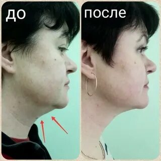 Смас шея отзывы