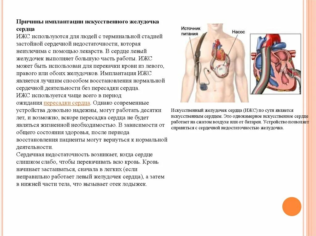 Схема искусственного сердца abiocor. Искусственный левый желудочек сердца. Искусственного левого желудочка (LVAD). Искусственный левый желудочек операция.