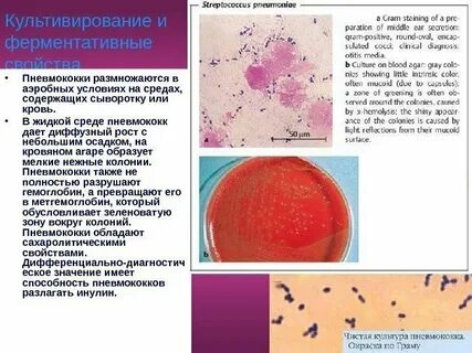 Стрептококки среды для культивирования