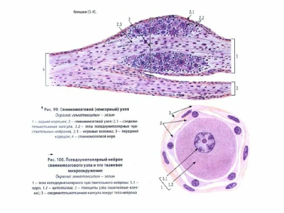 Спинальный ганглий гистология препарат. Спинномозговой узел препарат. Спинномозговой ганглий гистология препарат. Гистологический препарат спинномозгового узла.