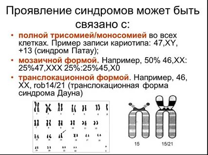 Кариотип 47 хх