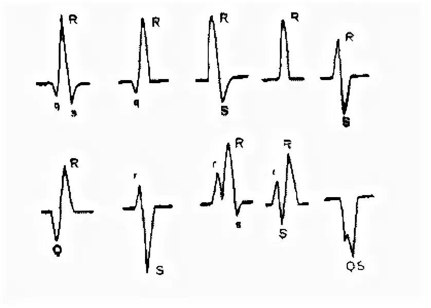 Варианты комплекса qrs. Qrs тонкий. Комплекс qrs типа qs. Комплекс qrs вида qrs. Номенклатура комплекса qrs.