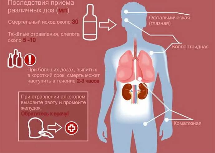 Влияние метанола. Отравление метанолом. Действие на организм метанола и этанола. Отравление метанолом симптомы.