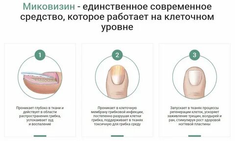 Грибка ногтей инструкция