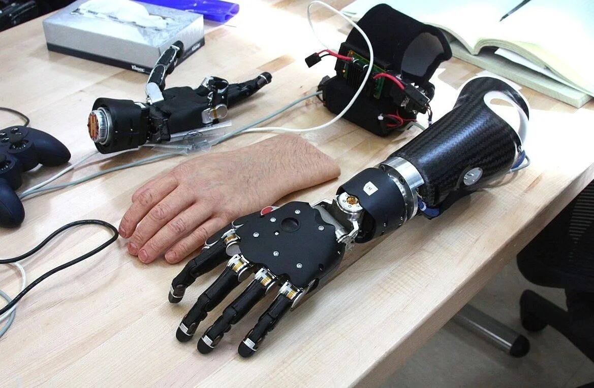 Бионический протез 4 руки. Touch Bionics протезы. Touch Bionics протез кисти. Нейробионика протезы.