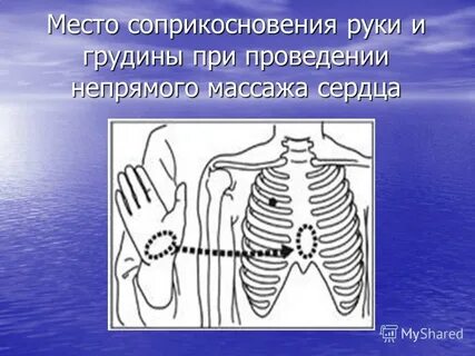 Место соприкосновения