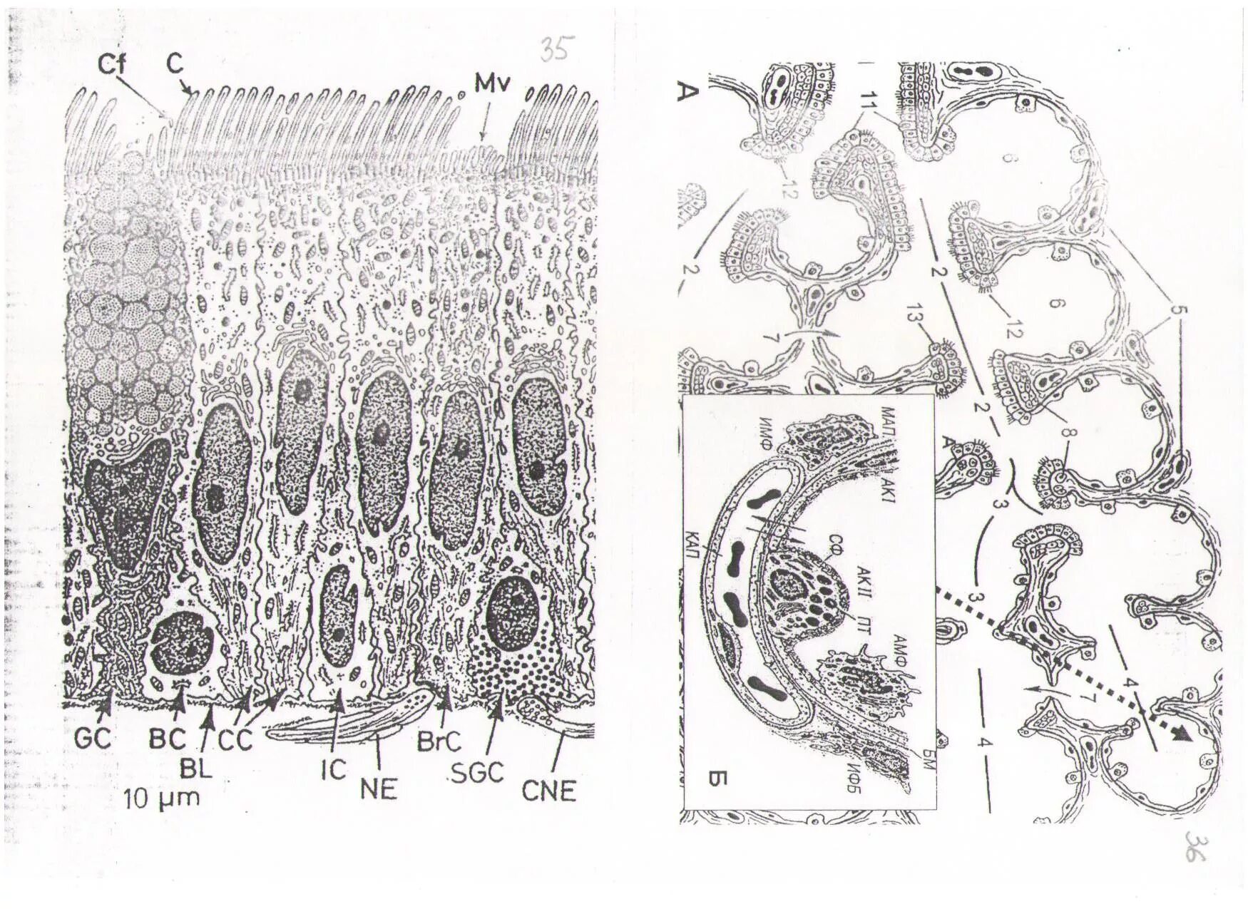 Клеточный состав эпителия слизистой оболочки воздухоносных путей. Строение воздухоносных путей гистология. Клеточный состав эпителия слизистой оболочки воздухоносных путей. Клетки воздухоносных путей. Клетки эпителия воздухоносных путей гистология.