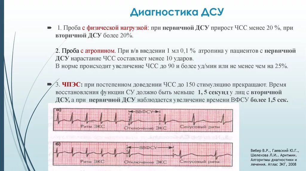 Дисфункция синусового узла что это. Нарушение функции синусного узла. ЭКГ после нагрузки прирост ЧСС. ЭКГ диагноз дисфункция синусового узла. Проба с физической нагрузкой ЭКГ.