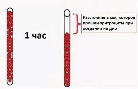 Скорость оседания эритроцитов 10