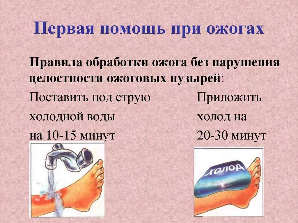 Что приложить при ожоге