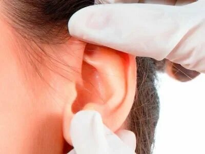 Герпес в ухе симптомы и лечение фото Labyrinthitis. Inflammation of the Inner Ear and Herpes Simplex Virus that Cause