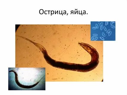 Острицы у взрослых отзывы